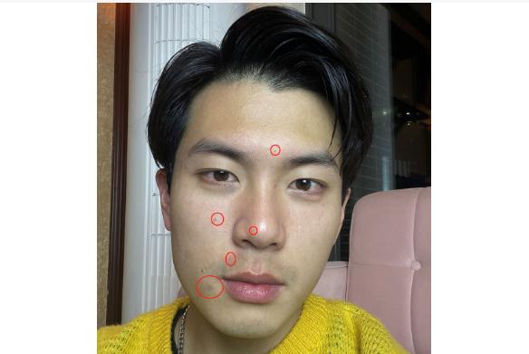 為什么男生皮膚會(huì)出油？男生皮膚出油怎么辦？